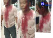 Warga Dikeroyok oleh Sekelompok Pemuda di Tapian Nauli, Korban Alami Luka Serius di Kepala!!