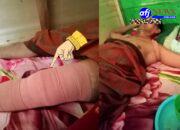 Laka Lantas di Jalan Lintas Simonis, Dua Bulan Korban Menunggu Tanggung Jawab Pelaku.