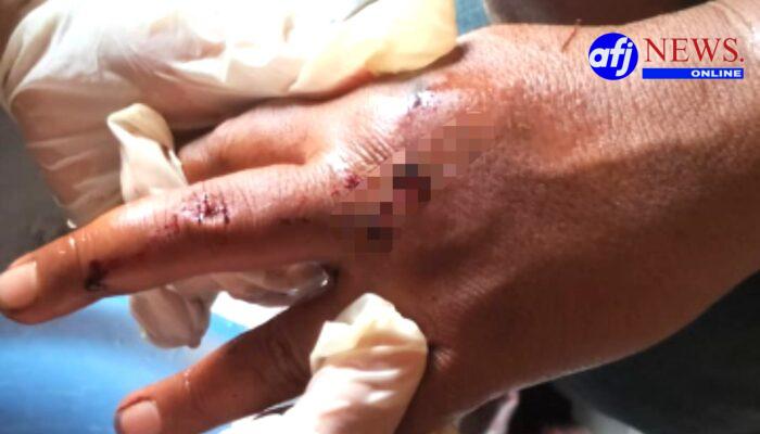 Diduga Kembali Terjadi Penganiayaan di Lahan Milik Drs. Robert Aritonang Cs, Korban Alami Luka Serius